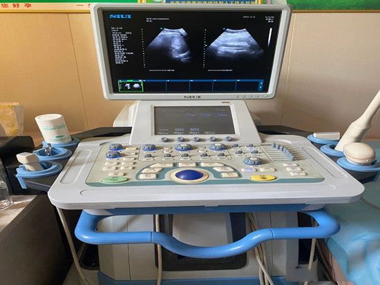 汕头3800四维彩超