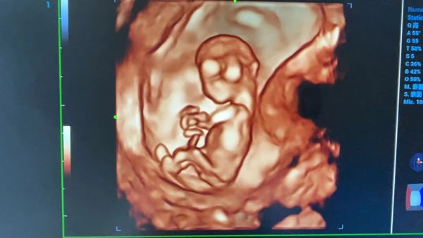 新时代的“女娲”传说——专为妇幼健康打造的超声设备