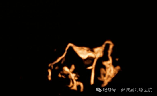 《备孕路上遇“堵车”？输卵管造影，可能是打开好孕的“金钥匙”》X线输卵管造影 VS 超声输卵管造影，谁更适合你？