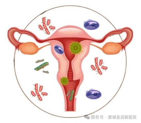 【健康科普】沉默的疼痛：盆腔炎，每个女性都该警惕的“隐形炸弹”
