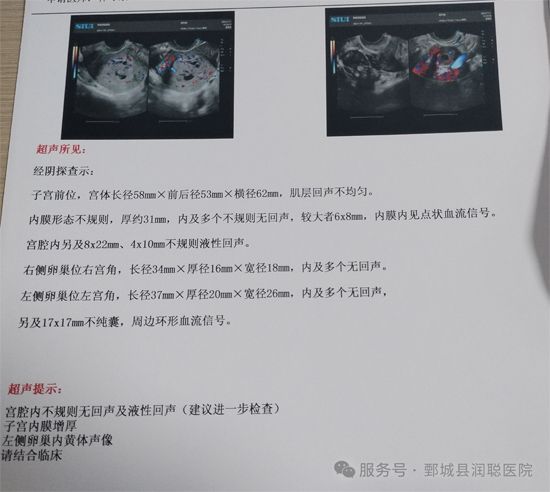 葡萄胎:一种特殊的妊娠