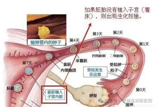读懂早孕的“悄然离场”：生化妊娠、空孕囊、胎停育与自然流产的区别与后续准备
