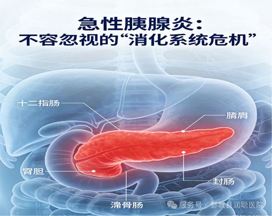 藏在腹 痛里的“胰腺危机”