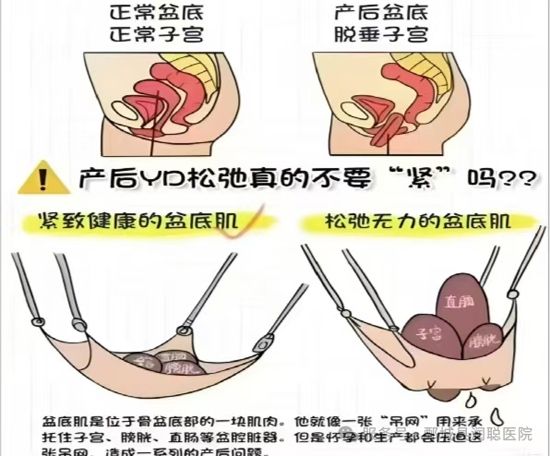 产后三大部位.盆底肌+腹直肌+骨盆，修复攻略你知道多少？