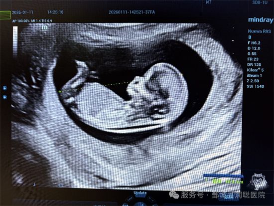 【健康科普】孕早期必看：NT检查——宝宝的第 一道“健康安检”