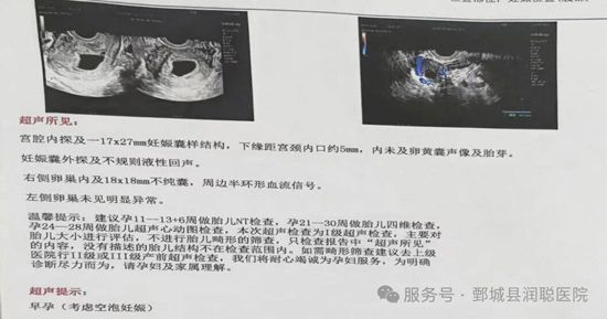 读懂早孕的“悄然离场”：生化妊娠、空孕囊、胎停育与自然流产的区别与后续准备