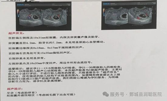 读懂早孕的“悄然离场”：生化妊娠、空孕囊、胎停育与自然流产的区别与后续准备