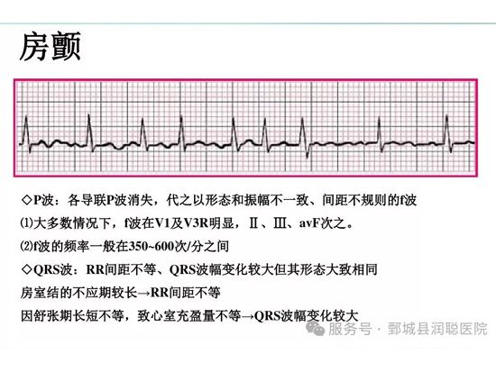 【健康科普】心房颤动：心脏发出的危险警报，您听懂了吗？