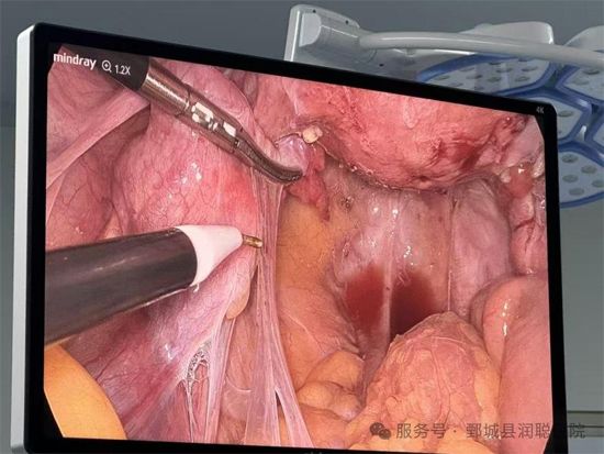 <img src=upfile/images/2026/04/02/small3_17750922174663770.jpg height=350>