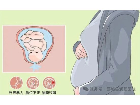 健康科普《宝宝的第 一道“防线”提前破了》------科学应对胎膜早破