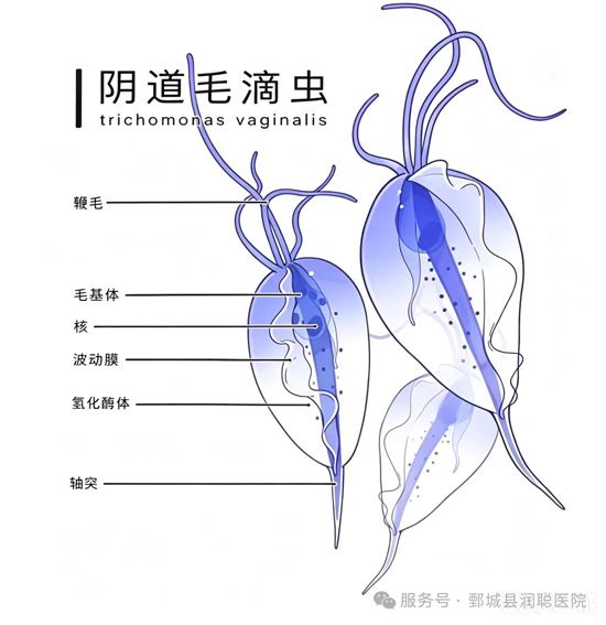 【健康科普】一张白带化验单，看懂私处小烦恼！4种阴道炎一次分清