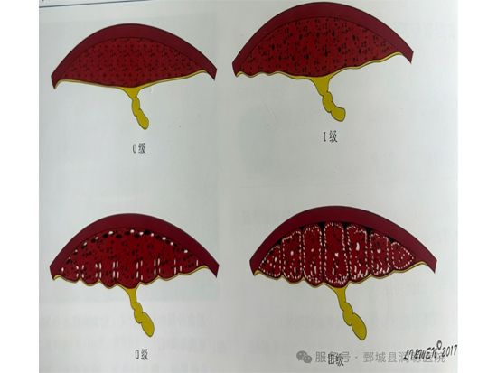 【健康科普】方寸胎盘，守护十月怀胎