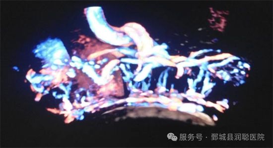 【健康科普】方寸胎盘，守护十月怀胎