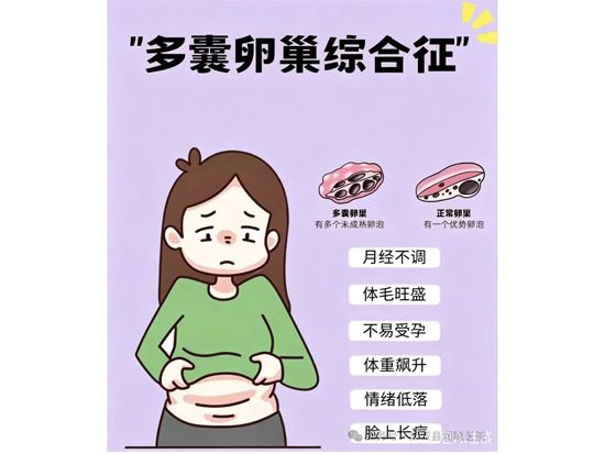 【健康科普】超声带你认识多囊卵巢综合征