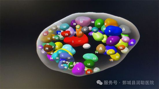 【健康科普】超声带你认识多囊卵巢综合征