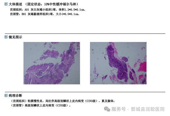 【健康科普】标准化阴道镜检查全过程，减少不必要焦虑