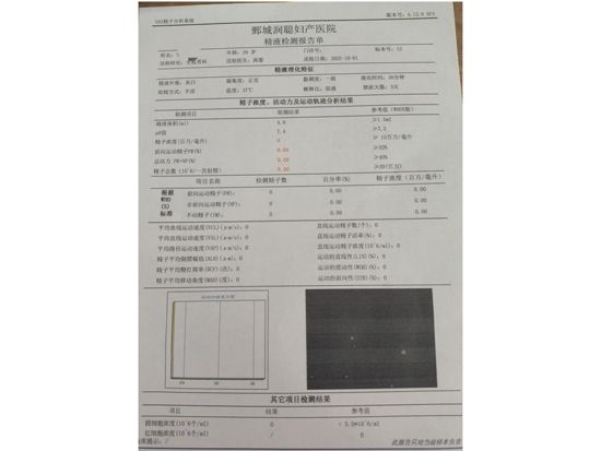 【健康科普】 无精子症都做哪些检查 ——高雷医师