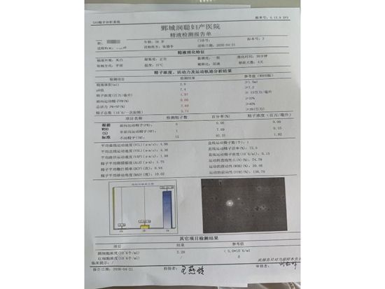 【健康科普】精子少是怎么回事？——张德争医师