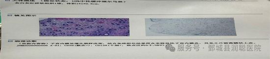 【健康科普】子宫内膜炎:关于子宫“土壤”的炎症,你了解多少?——李淑霞
