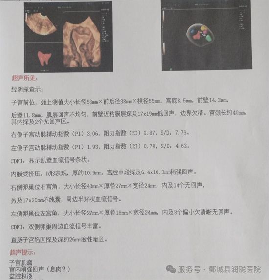 【健康科普】藏在宫腔里的“小异物”——带你读懂黏膜下子宫肌瘤——邵凤霞