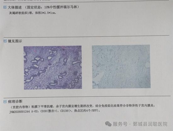 【健康科普】藏在宫腔里的“小异物”——带你读懂黏膜下子宫肌瘤——邵凤霞