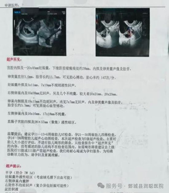 【健康科普】怀了“双胞胎”，却一个在宫内一个在宫外？带你认识“复合妊娠”——李慧医师
