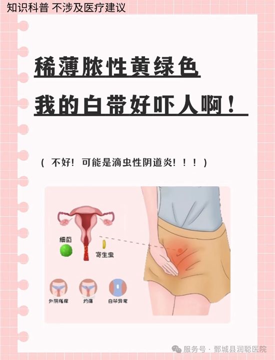 【健康科普】黄绿色、泡沫状、有异味？当心滴虫性阴道炎在“作祟”——卞临明