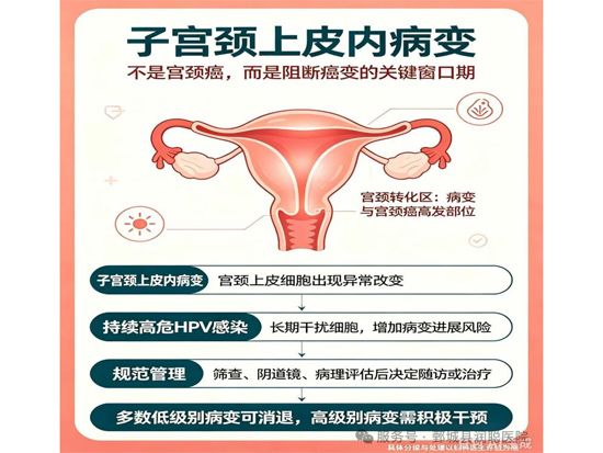 【健康科普】关爱女性健康：读懂“宫颈上皮内病变”，远离宫颈癌——李慧