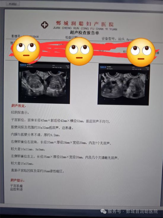 【健康科普】当怀孕遇上子宫肌瘤，该怎么办？——李凤娇  