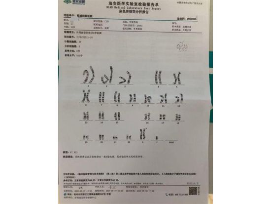 无精子症是什么原因造成的？——高雷医师